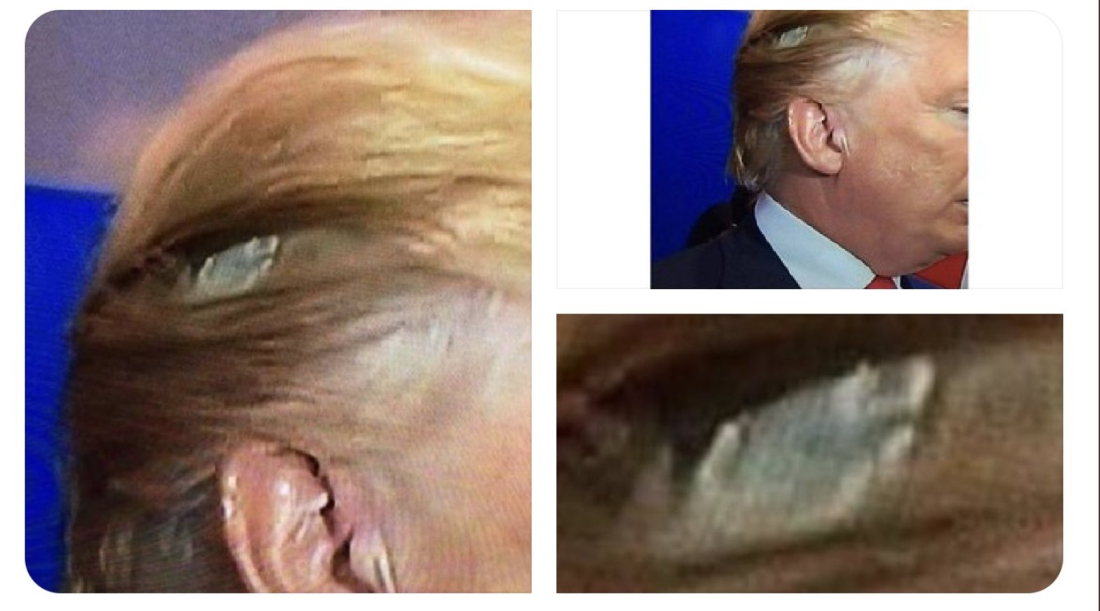 PHOTO Donald Trump's Track Was Showing In His Hair During Debate