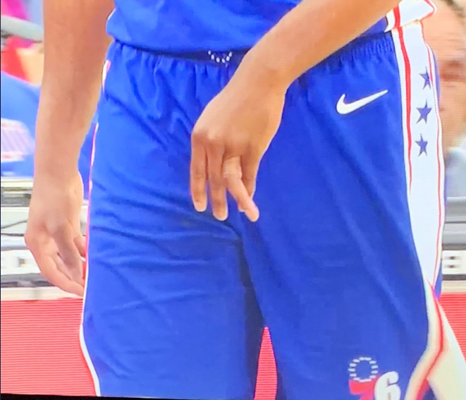 PHOTO Joel Embiid's Finger Out Of Place