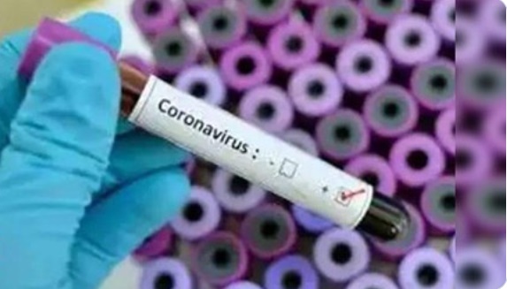 PHOTO What The Corona Virus Testing Kit Looks Like