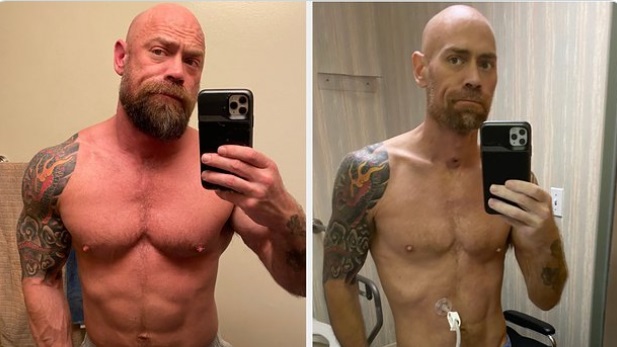 PHOTO Built Man With His Muscles And 6 Pack Vs After He Was In The Hopsital For COVID-19 Skinnier And Pale