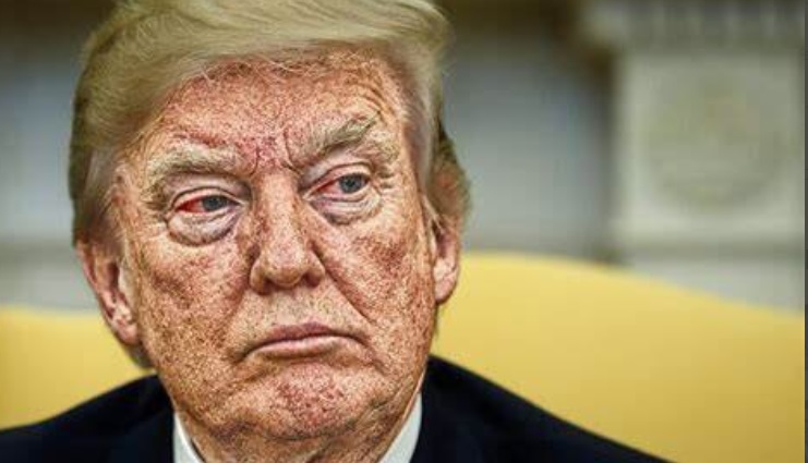 PHOTO Donald Trump With A Skin Rash On His Face